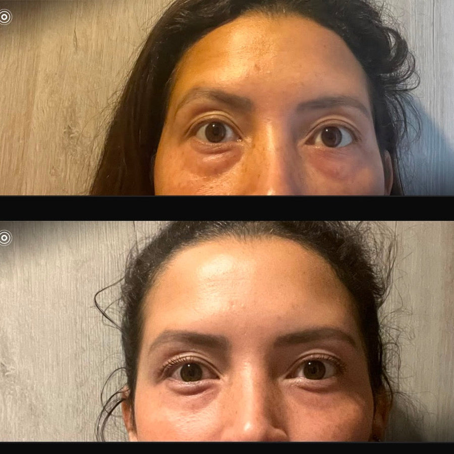 Ritual ojos hinchados 11 minutos